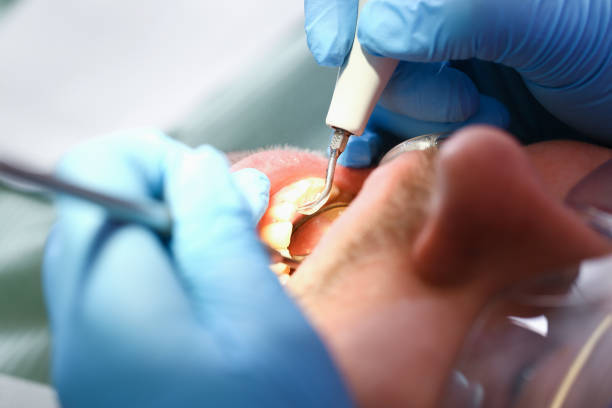 Best Pediatric Emergency Dentist in Lan, MI