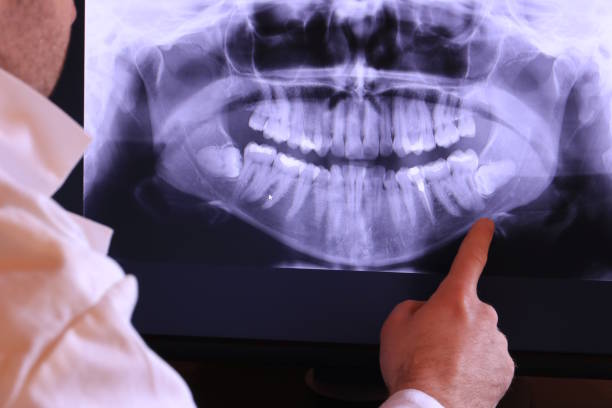 Best Broken or Cracked Tooth Emergency Dentist in Lan, MI