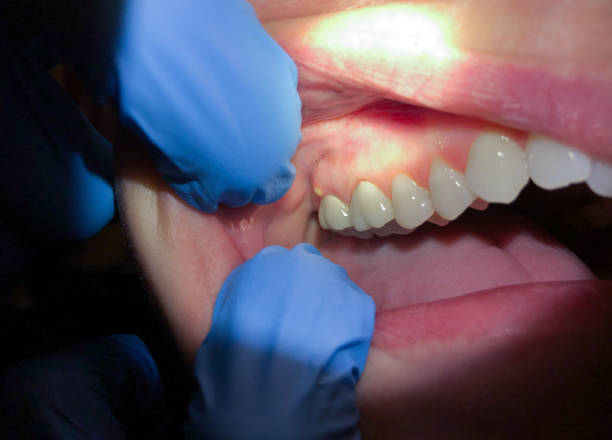 Best Emergency Dental Services for Seniors in Lan, MI
